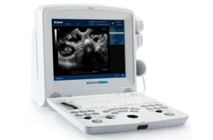 Ultrazvukový skener EDAN DUS60